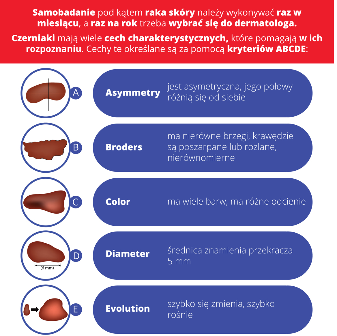 samobadanie ABCDE rak skory.jpg